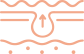 유착해결