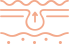 유착해결
