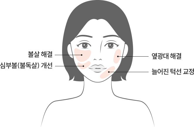 여우각 페이스 주사