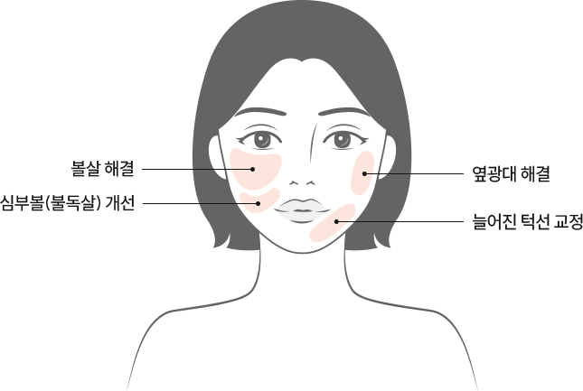 여우각 페이스 주사