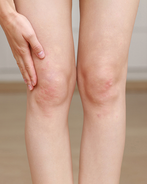 Knees