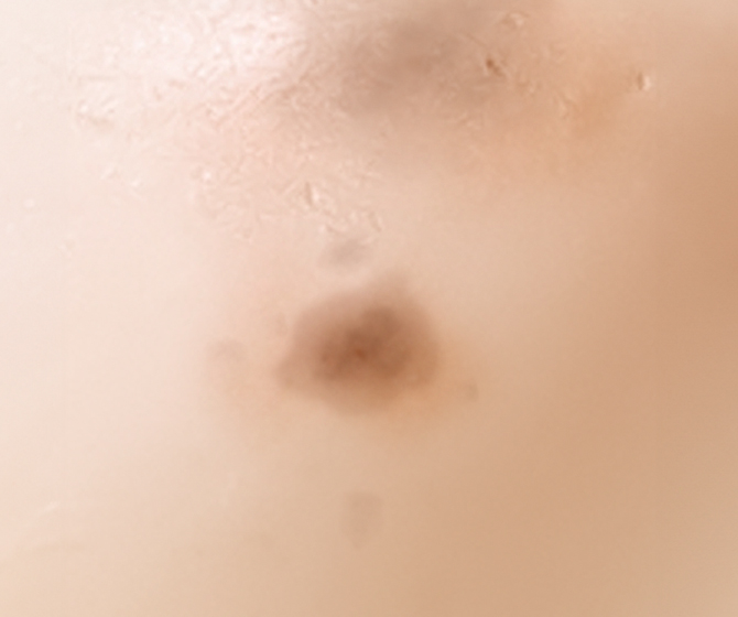 바디토닝